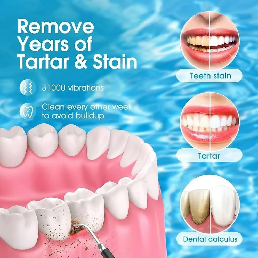 Sonic Ultra Teeth Cleaner